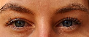 eye discomfort