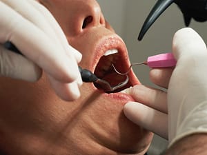 teeth