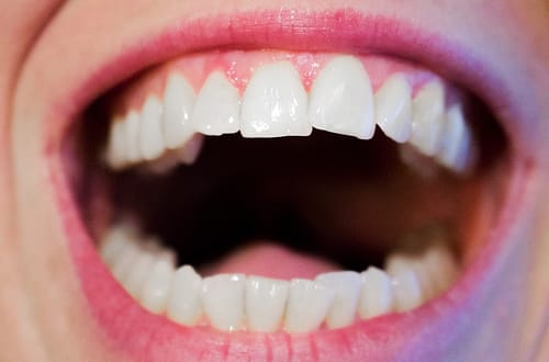 teeth