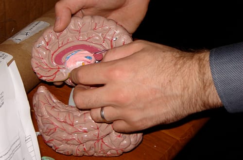 Parkinson's Disease