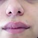 woman with herpes 2