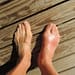swollen big toe