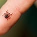 bug on finger