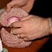 Parkinson's Disease