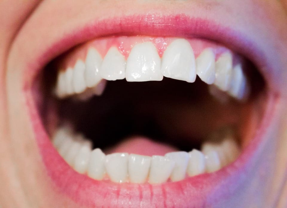 woman showing teeth